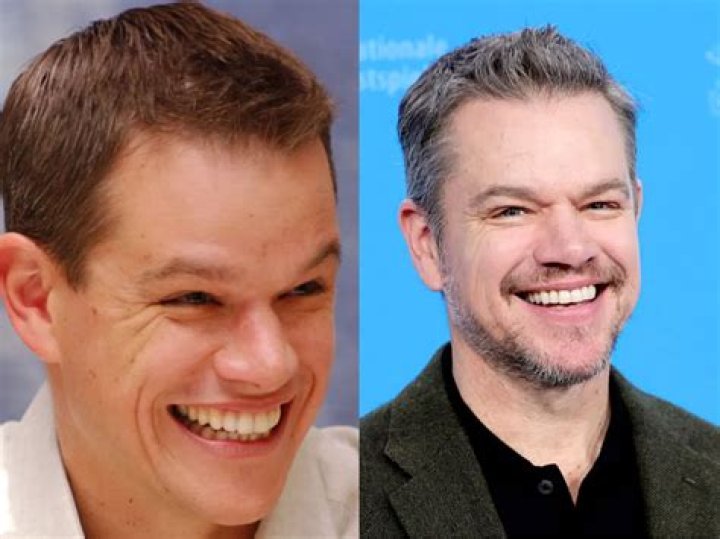 Before And After Photos Of Roberto Firmino Teeth- Explore His New Looks