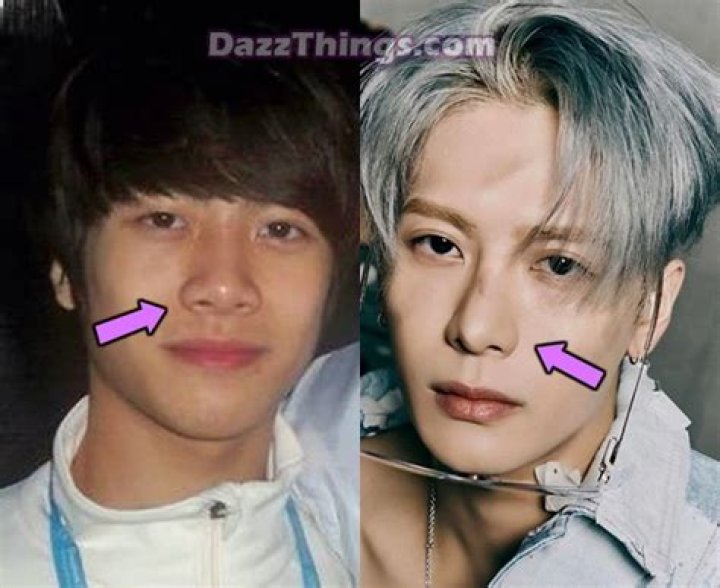 Did Jackson Wang Get Plastic Surgery? Here Are The Singer’s Before And After Pictures