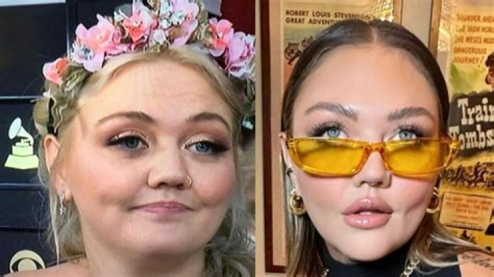 Elle King Taking Help From Plastic Surgery or What?