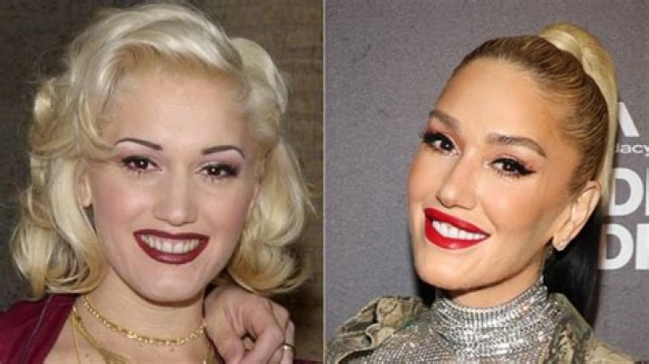 
Gwen Stefani Before Plastic Surgery, Who Is Gwen Stefani? Gwen Stefani Wikipedia, Age, Height, Husband, And Net Worth 