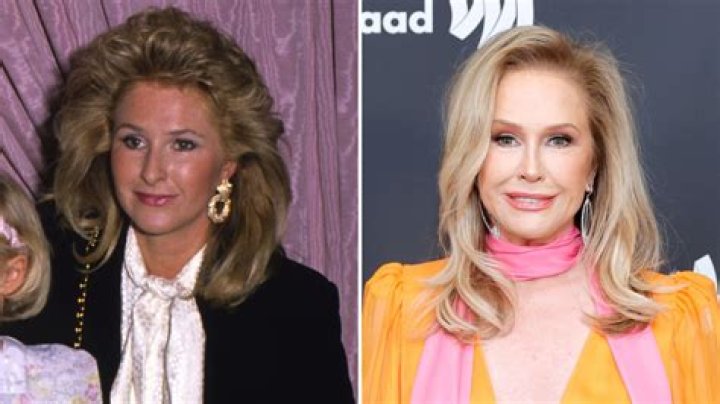 
Has RHOBH Kathy Hilton Done Plastic Surgery? Fans Suspect Botox And Nose Job 