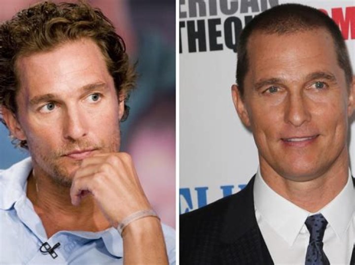 Is Matthew McConaughey Balding? Actor Provides Details On His Hair Transformation