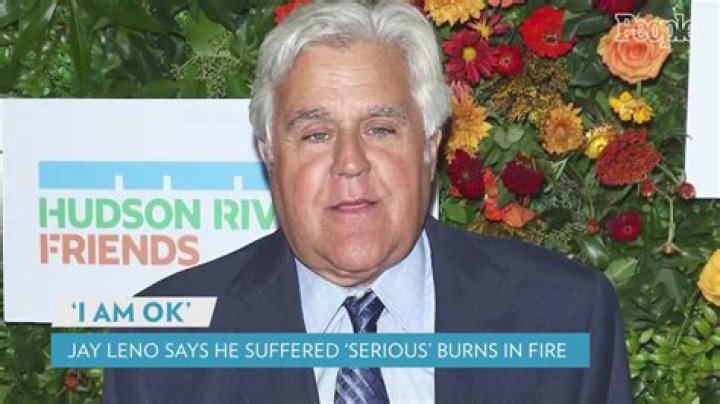 
Jay Leno Says He Suffered ‘Serious’ Burns After Being Involved in Gasoline Fire: ‘I Am OK’ 