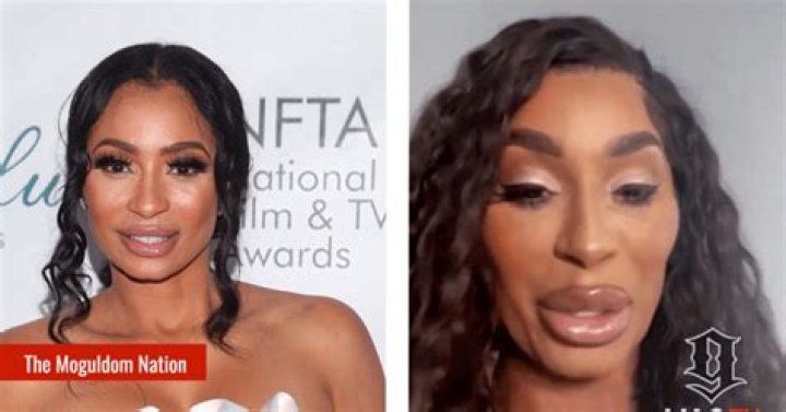 Karlie Redd New Face & Plastic Surgery: Before After Photos Hints Its More Than Lip Injections