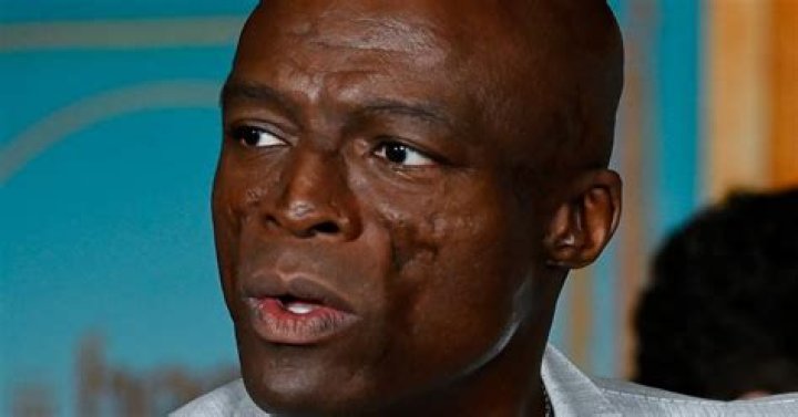 What Happened To Seal’s Face? Details On His Illness And Facial Scars