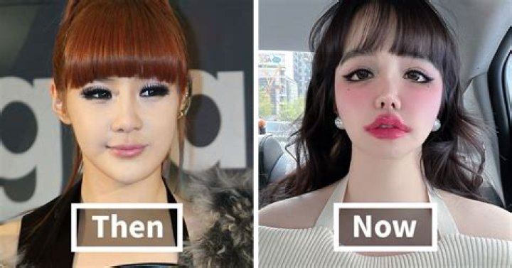 What Is Ekin Su Real Name? Here Are Her Before And After Plastic Surgery Pictures